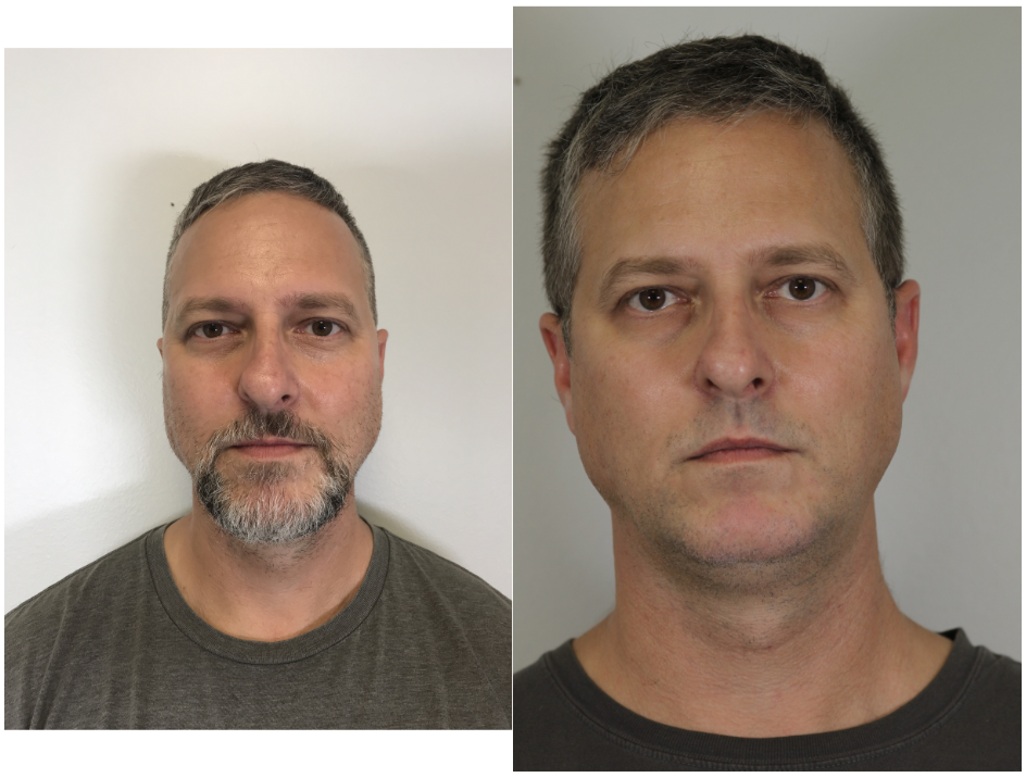 before and after comparison