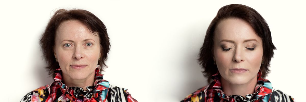 before and after photos of woman patient