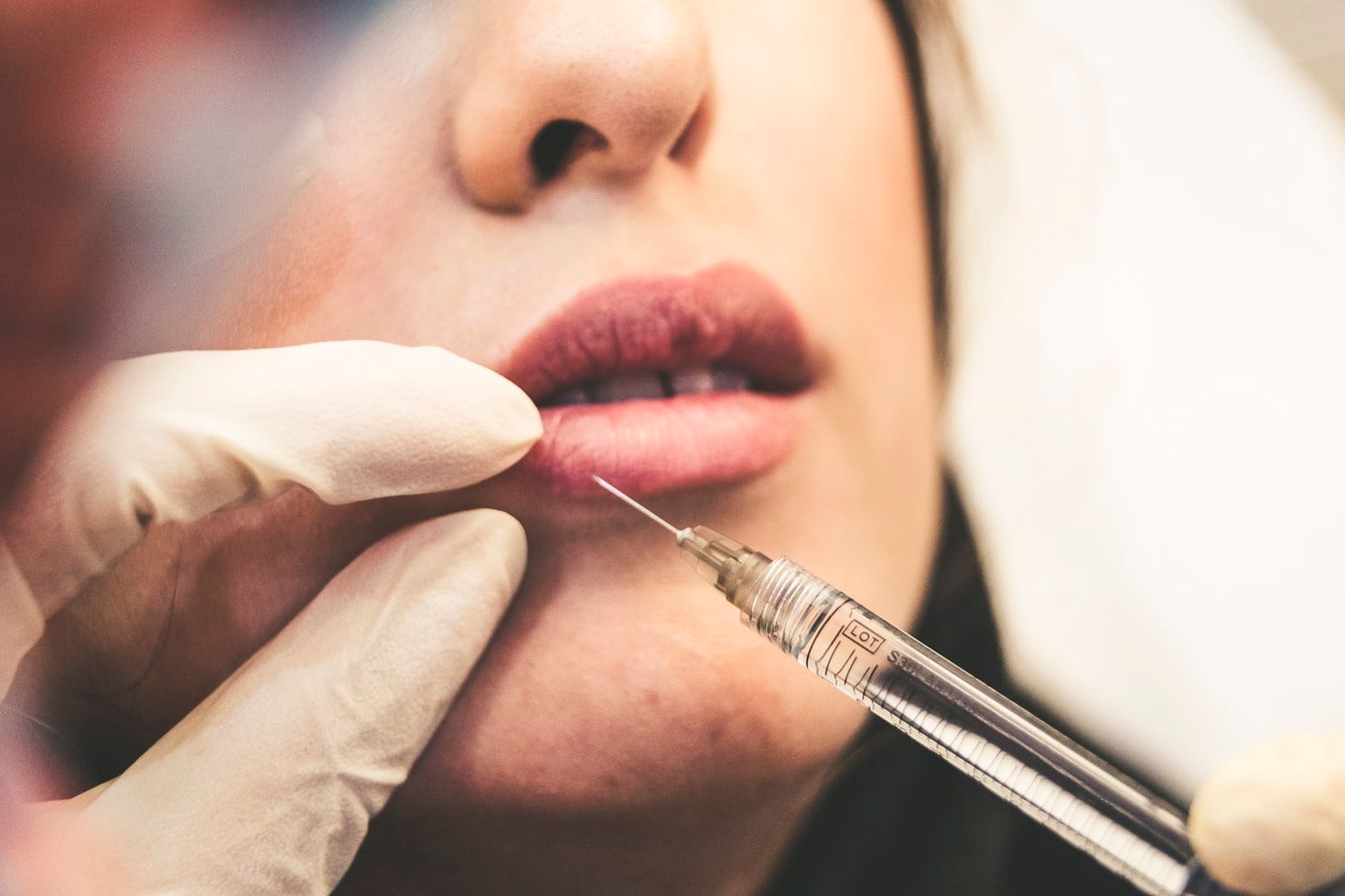 woman getting lip injections
