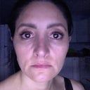 Most Popular Answers from Raghu Athré, MD