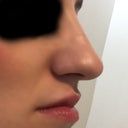 Most Popular Answers From Raghu Athre