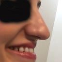 Most Popular Answers From Raghu Athre