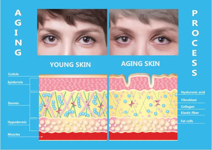 As skin ages, the collagen and elastin that help support the skin start to break down.