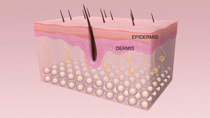 The skin is composed of layers. The most superficial layer is the epidermis. Underneath the epidermis is the dermis. Beneath that are the connective structures that support the skin.