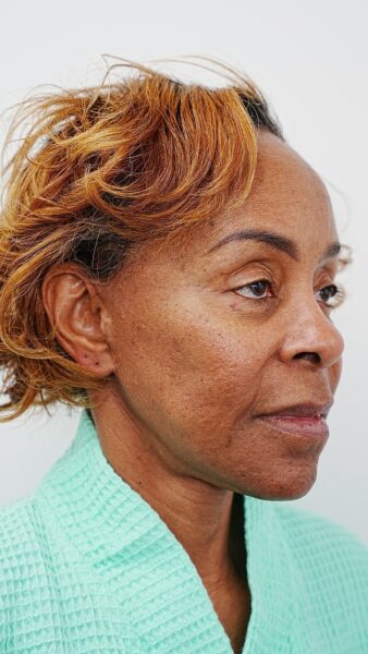 A middle-aged woman with short, curly, light brown hair is wearing a light green textured robe, viewed from a right side profile against a plain background.