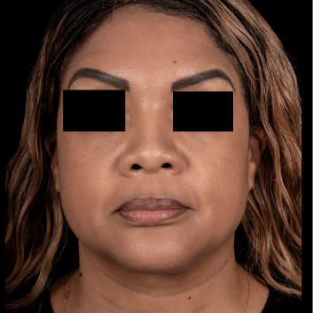 African-American-Nose